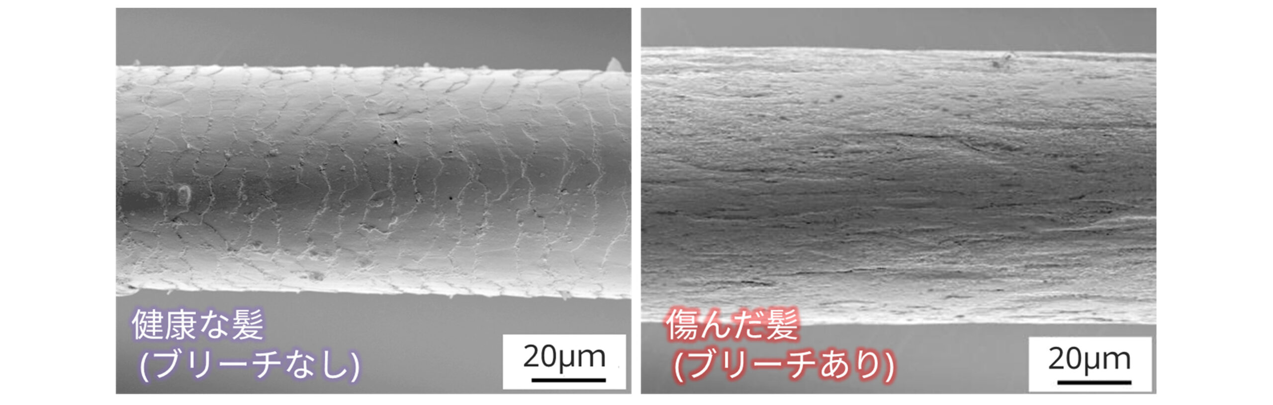 走査型透過X線顕微鏡 (STXM) による毛髪の観察