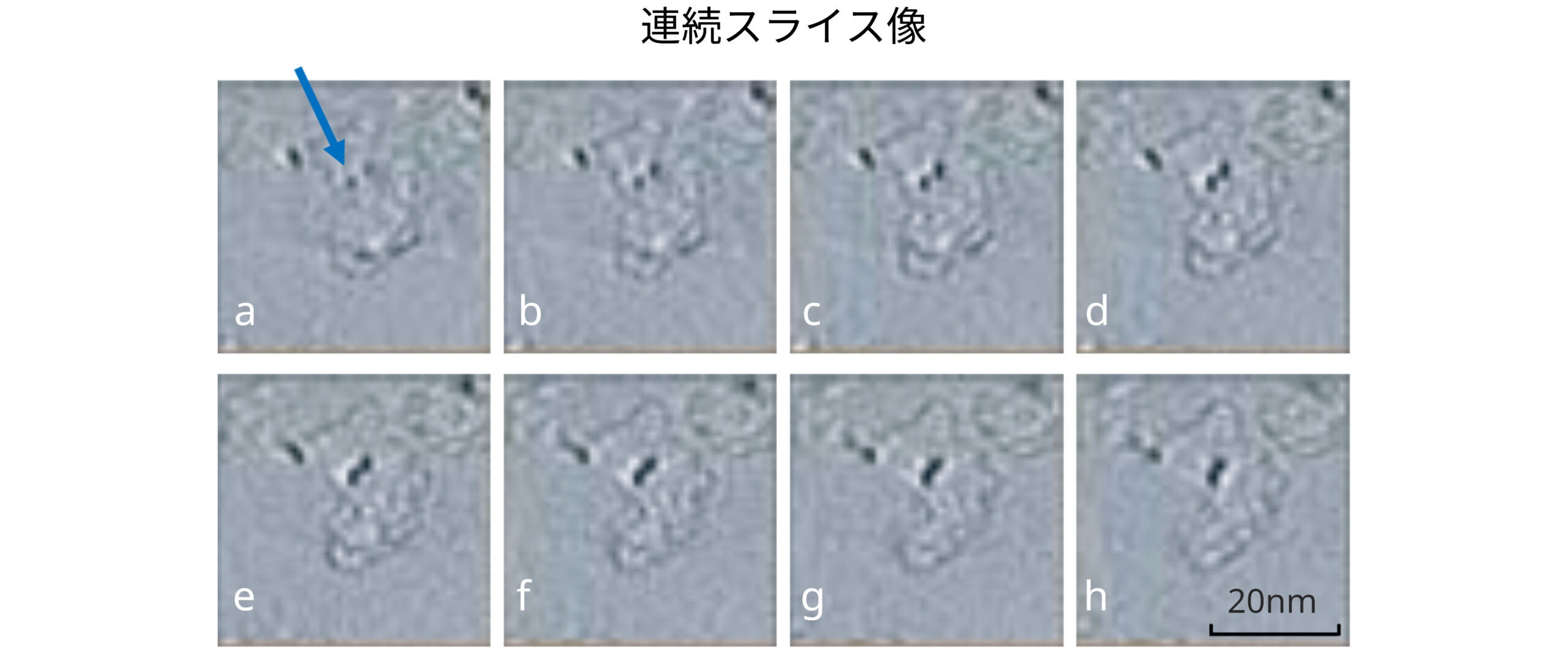 連続スライス像