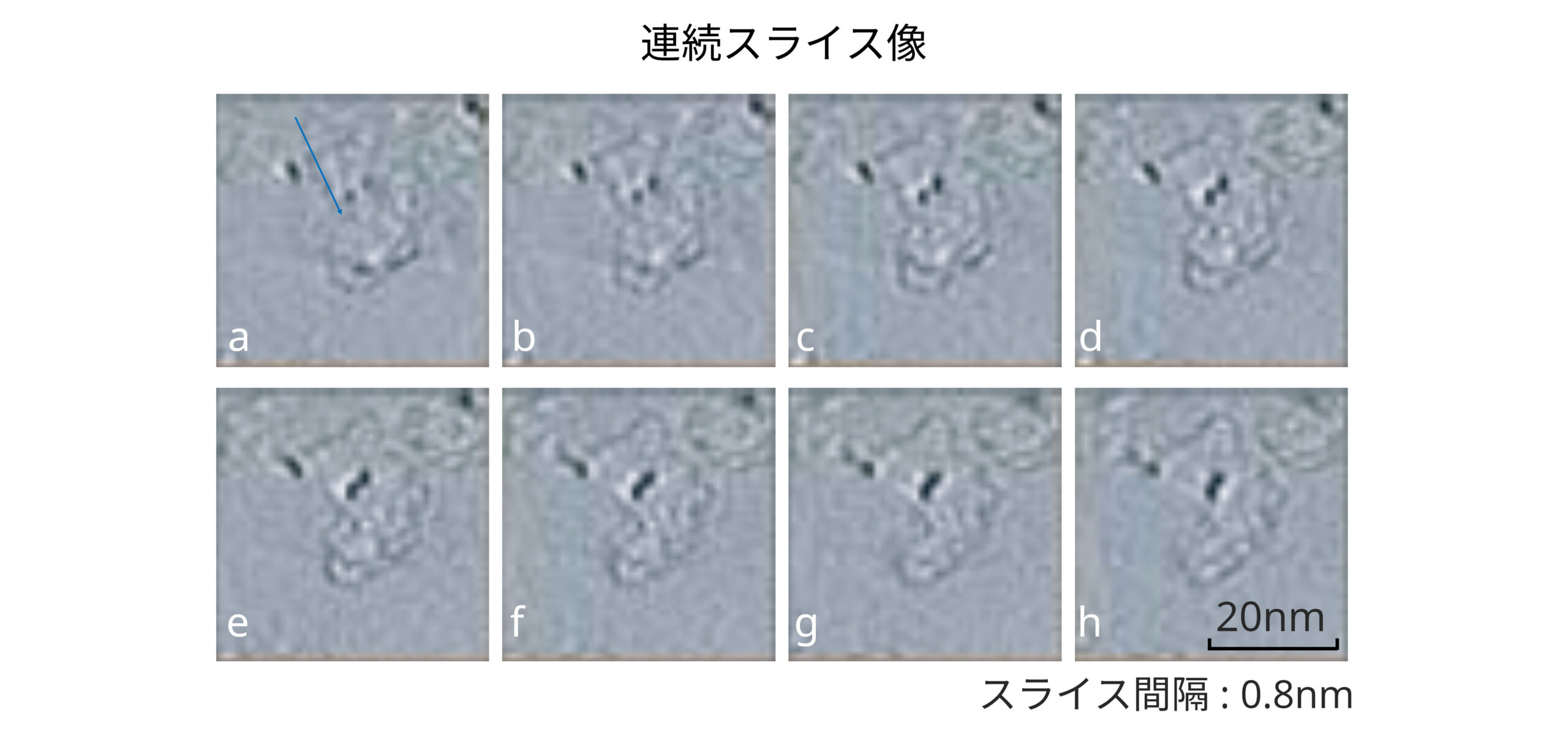 連続スライス像