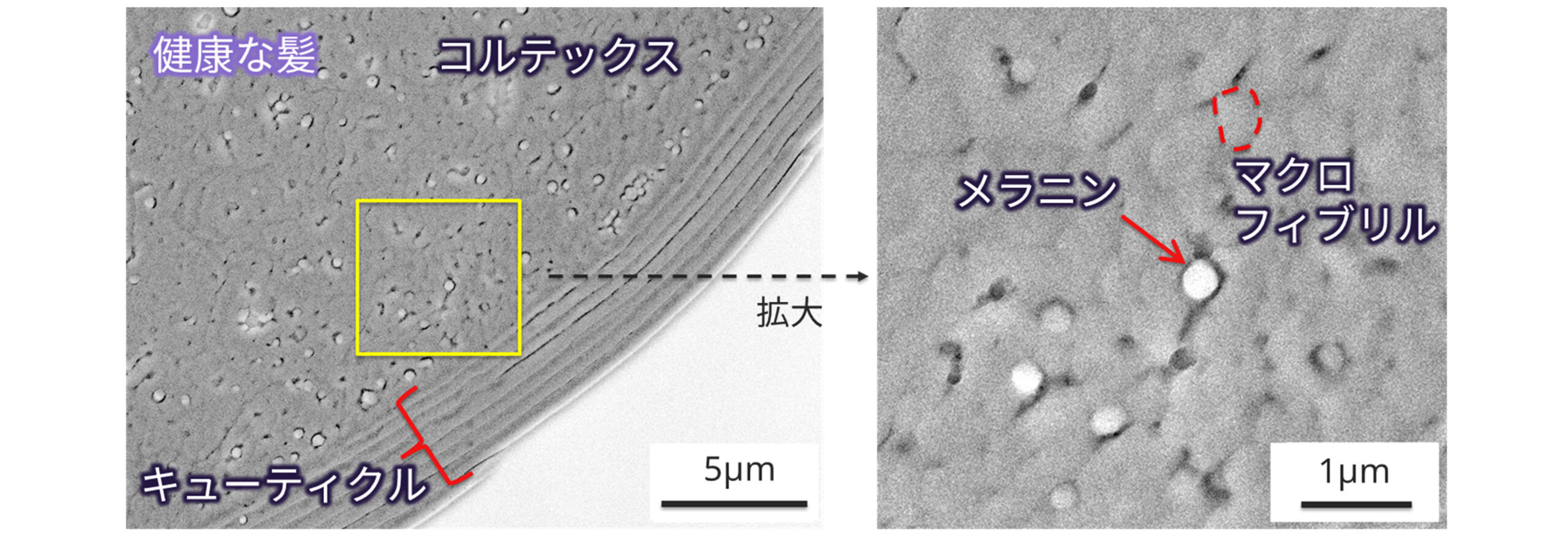 クライオSEMによる毛髪の形態観察