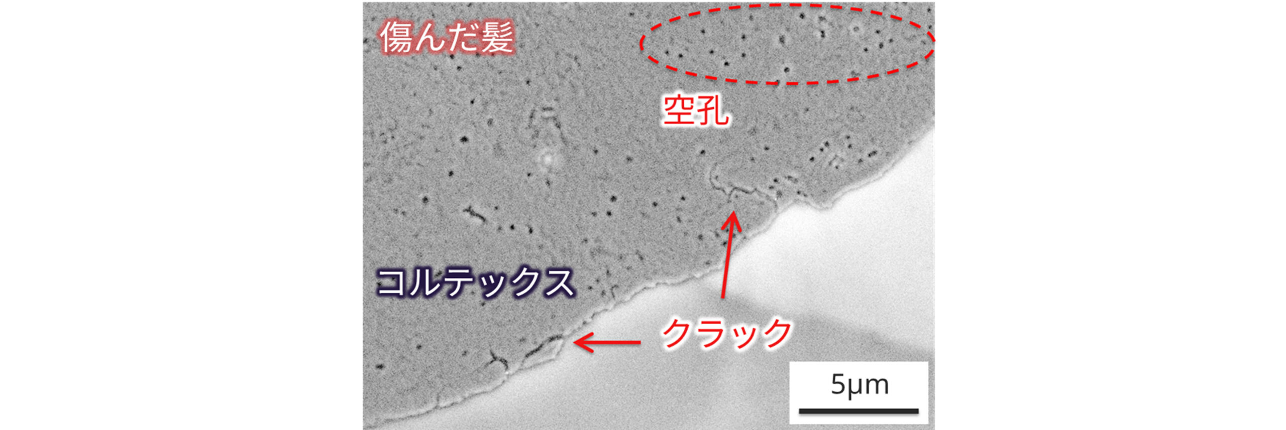 クライオSEMによる毛髪の形態観察