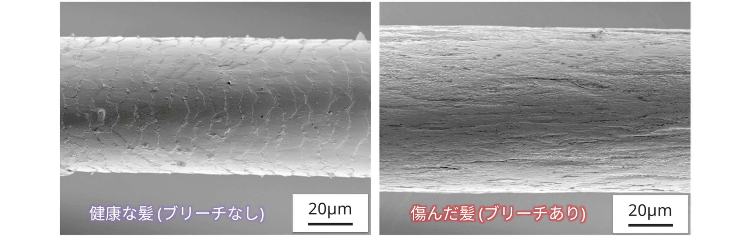 毛髪の表面形態