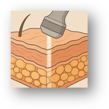 皮膚内部の非侵襲解析のイメージ図